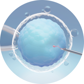 난자세포질 내 정자 직접주입술