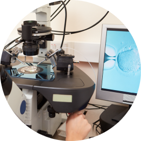 방추사 관찰 시스템