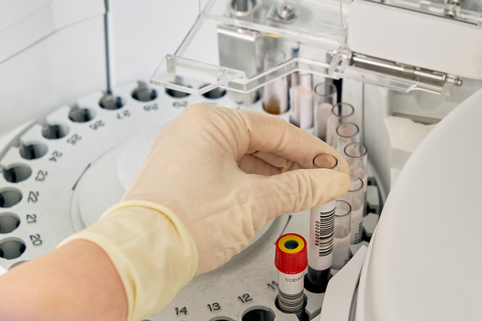 난소기능저하 검사 방법